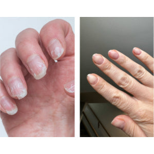 Nail Health 101: How to Strengthen Thin Nails Naturally